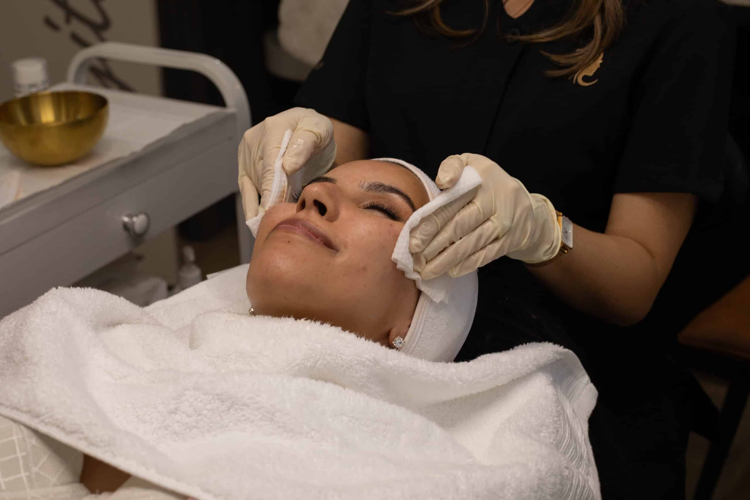 Dermal Peel Process