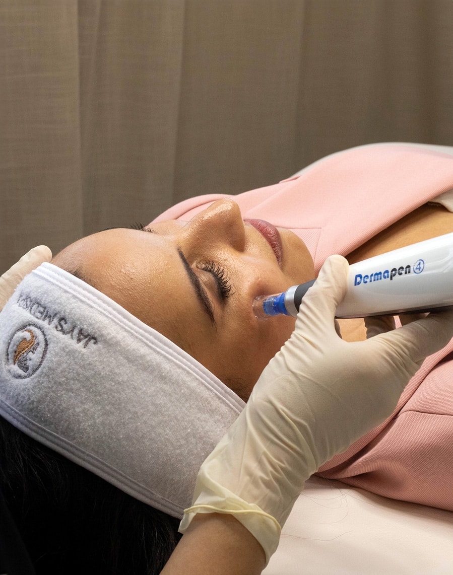 Microneedling