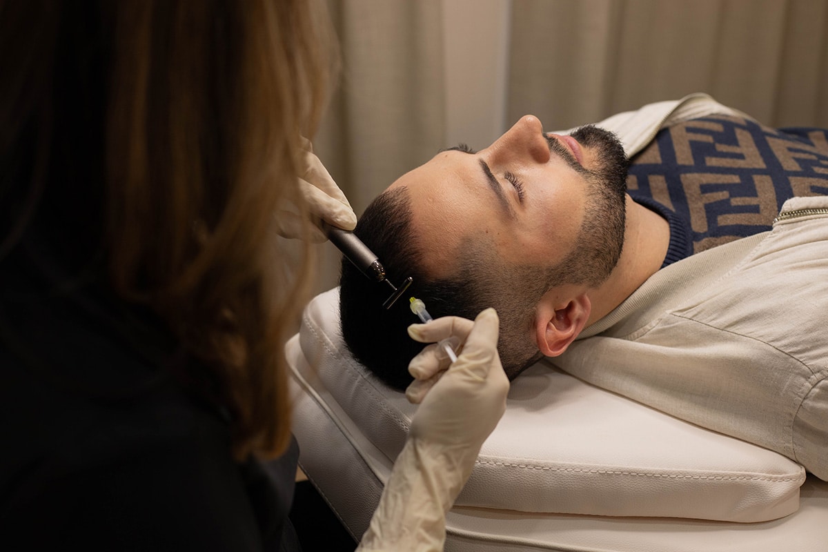 Hair restoration treatment being performed at Jay’s Medispa using growth factor serums and microneedling.